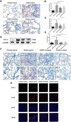 An Herbal Product Alleviates Bleomycin-Induced Pulmonary Fibrosis in Mice via Regulating NF-κB/TNF-α Signaling in Macrophages